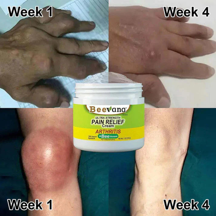 Bee Venom Ultra Strength Pain Relief Cream (Pack of 2)